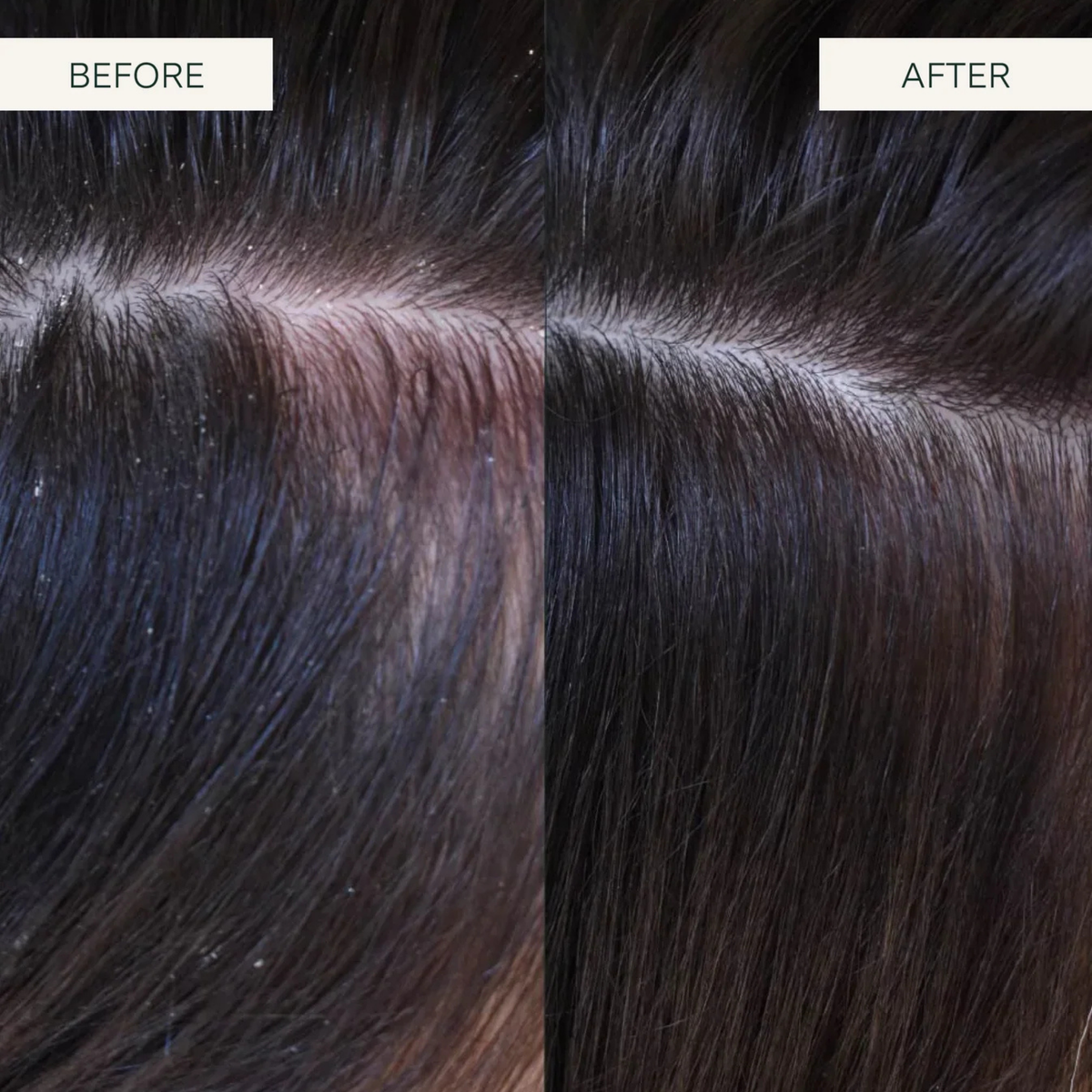 Scalp Exfoliating Shampoo